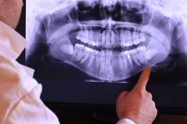 Best Broken or Cracked Tooth Emergency Dentist in Heritage Hills, NY