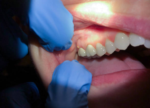 Best Mobile Emergency Dentist in Heritage Hills, NY