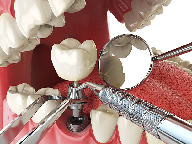 Best Emergency Cosmetic Dentistry in Heritage Hills, NY